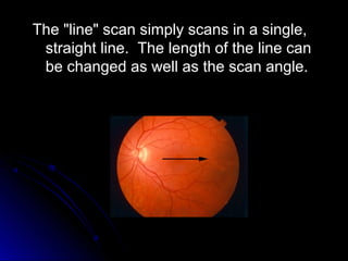 The "line" scan simply scans in a single,
 straight line. The length of the line can
 be changed as well as the scan angle.
 