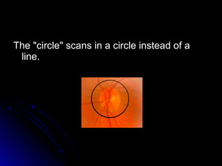 The "circle" scans in a circle instead of a
 line.
 