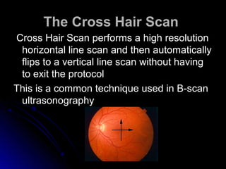 The Cross Hair Scan
Cross Hair Scan performs a high resolution
 horizontal line scan and then automatically
 flips to a vertical line scan without having
 to exit the protocol
This is a common technique used in B-scan
 ultrasonography
 