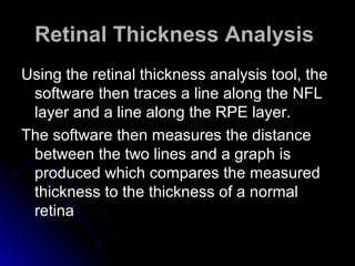 Retinal Thickness Analysis
Using the retinal thickness analysis tool, the
 software then traces a line along the NFL
 layer and a line along the RPE layer.
The software then measures the distance
 between the two lines and a graph is
 produced which compares the measured
 thickness to the thickness of a normal
 retina
 