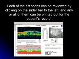 Each of the six scans can be reviewed by
clicking on the slider bar to the left, and any
   or all of them can be printed out for the
                patient's record
 
