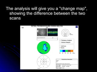 The analysis will give you a "change map",
 showing the difference between the two
 scans
 