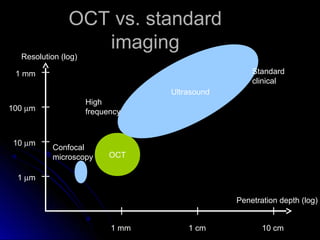 OCT vs. standard
                  imaging
  Resolution (log)

 1 mm                                              Standard
                                                   clinical
                                  Ultrasound
                     High
100 µm               frequency


 10 µm
          Confocal
          microscopy       OCT

  1 µm

                                               Penetration depth (log)


                           1 mm       1 cm            10 cm
 