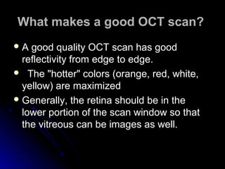 What makes a good OCT scan?
A  good quality OCT scan has good
  reflectivity from edge to edge.
 The "hotter" colors (orange, red, white,
  yellow) are maximized
 Generally, the retina should be in the
  lower portion of the scan window so that
  the vitreous can be images as well.
 