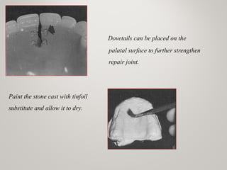 Dovetails can be placed on the
palatal surface to further strengthen
repair joint.
Paint the stone cast with tinfoil
substitute and allow it to dry.
www.indiandentalacademy.com
 