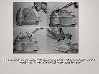 Modeling clay can be used to hold pieces while luting denture with sticky wax and
reinforcing with wood sticks before removing from clay.
www.indiandentalacademy.com
 