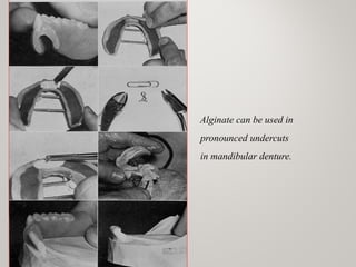 Alginate can be used in
pronounced undercuts
in mandibular denture.
www.indiandentalacademy.com
 