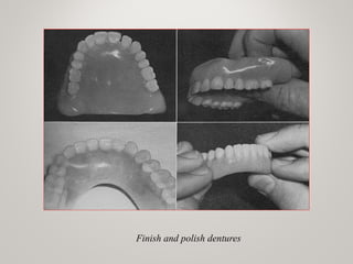 Finish and polish dentures
 