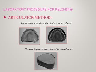 LABORATORY PROCEDURE FOR RELINING
► ARTICULATOR METHOD:-
Impression is made in the denture to be relined.
Denture impression is poured in dental stone.
 