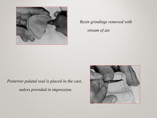 Resin grindings removed with
stream of air.
Posterior palatal seal is placed in the cast,
unless provided in impression.
www.indiandentalacademy.com
 