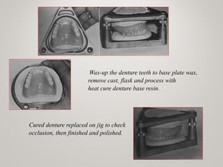 Wax-up the denture teeth to base plate wax,
remove cast, flask and process with
heat cure denture base resin.
Cured denture replaced on jig to check
occlusion, then finished and polished.
www.indiandentalacademy.com
 