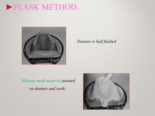 ►FLASK METHOD:-
Denture is half flasked
Silicone mold material painted
on denture and teeth.
 