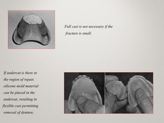 Full cast is not necessary if the
fracture is small.
If undercut is there in
the region of repair,
silicone mold material
can be placed in the
undercut, resulting in
flexible cast permitting
removal of denture,
 