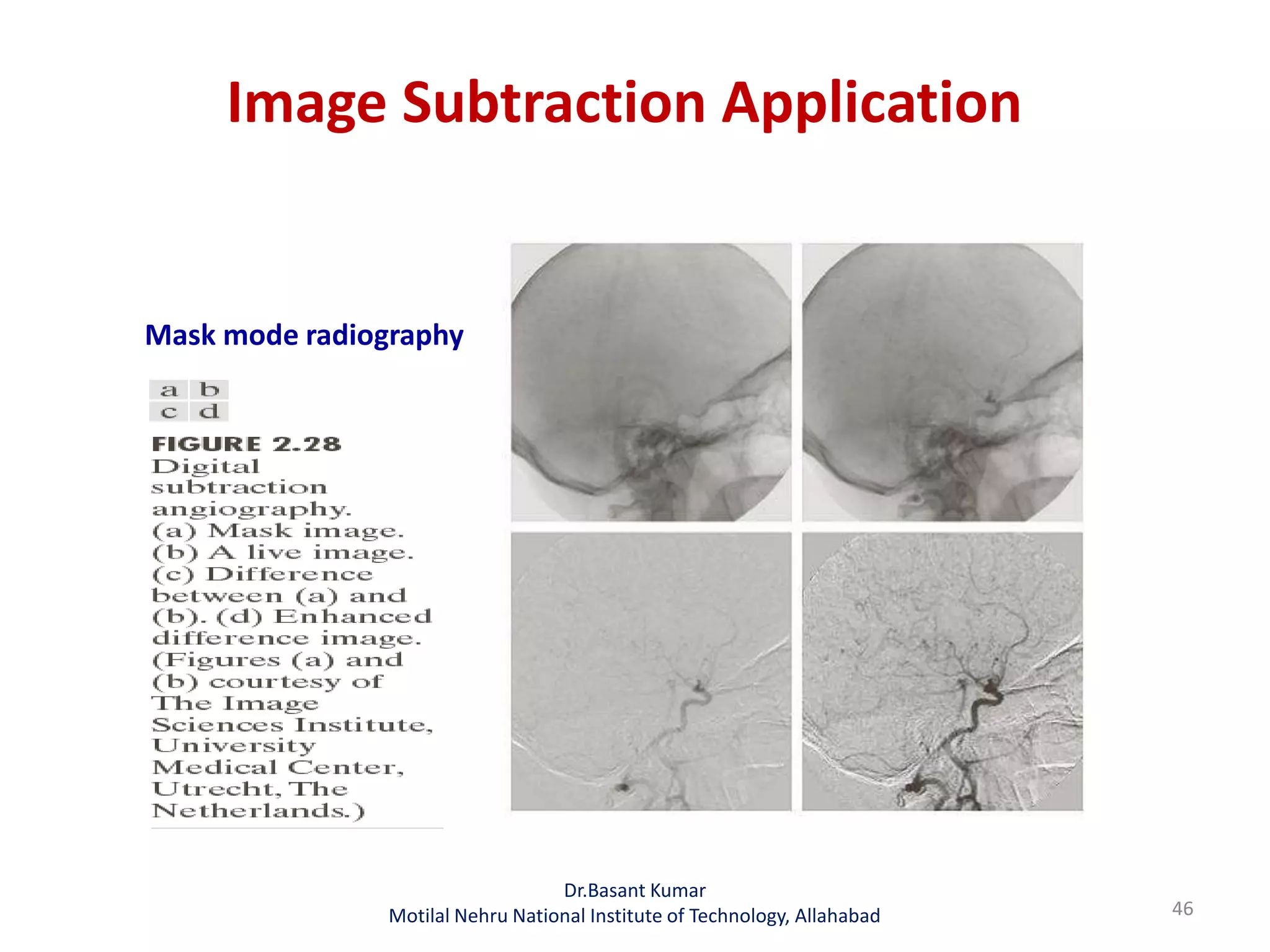 Image Subtraction Application
46
Mask mode radiography
Dr.Basant Kumar
Motilal Nehru National Institute of Technology, Allahabad
 