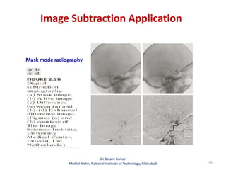 Image Subtraction Application
46
Mask mode radiography
Dr.Basant Kumar
Motilal Nehru National Institute of Technology, Allahabad
 