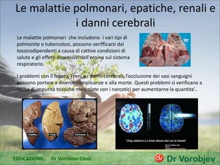 Le malattie polmonari, epatiche, renali e
i danni cerebrali
Le malattie polmonari che includono i vari tipi di
polmonite e tubercolosi, possono verifficarsi dai
tossicodipendenti a causa di cattive condizioni di
salute e gli effetti depressivi dell'eroina sul sistema
respiratorio.
I problemi con il fegato, i reni e i danni cerebrali, l’occlusione dei vasi sanguigni
possono portare a diverse complicanze e alla morte. Questi problemi si verificano a
causa di impurità tossiche mescolate con i narcotici per aumentarne la quantita’..
EDUCAZIONE: Dr Vorobiev Clinic
 