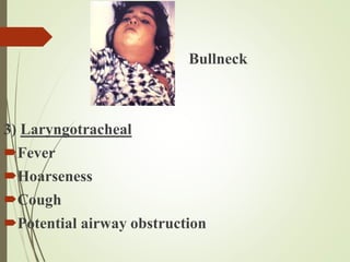 Bull Bullneck
3) Laryngotracheal
Fever
Hoarseness
Cough
Potential airway obstruction
 