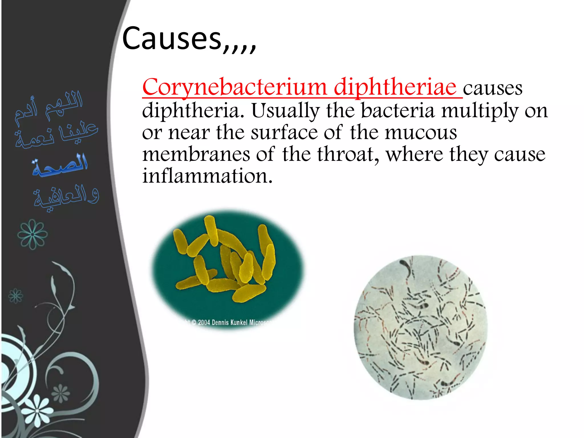 Diphtheria | PPT
