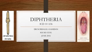 DIPHTHERIA
ICD 10 A36
DR NURDALILA SAHIDAN
KK KG GIAL
JUNE 2016
 