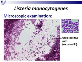 Listeria monocytogenes
Gram-positive
rods
(coccobacilli)
Microscopic examination:
 