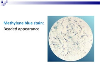 Methylene blue stain:
Beaded appearance
 