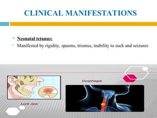 CLINICAL MANIFESTATIONS
 Neonatal tetanus:
 Manifested by rigidity, spasms, trismus, inability to suck and seizures
 