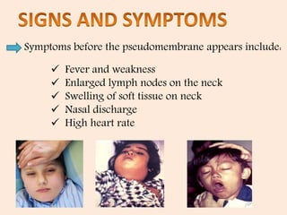 Diphtheria ppt | PPTX