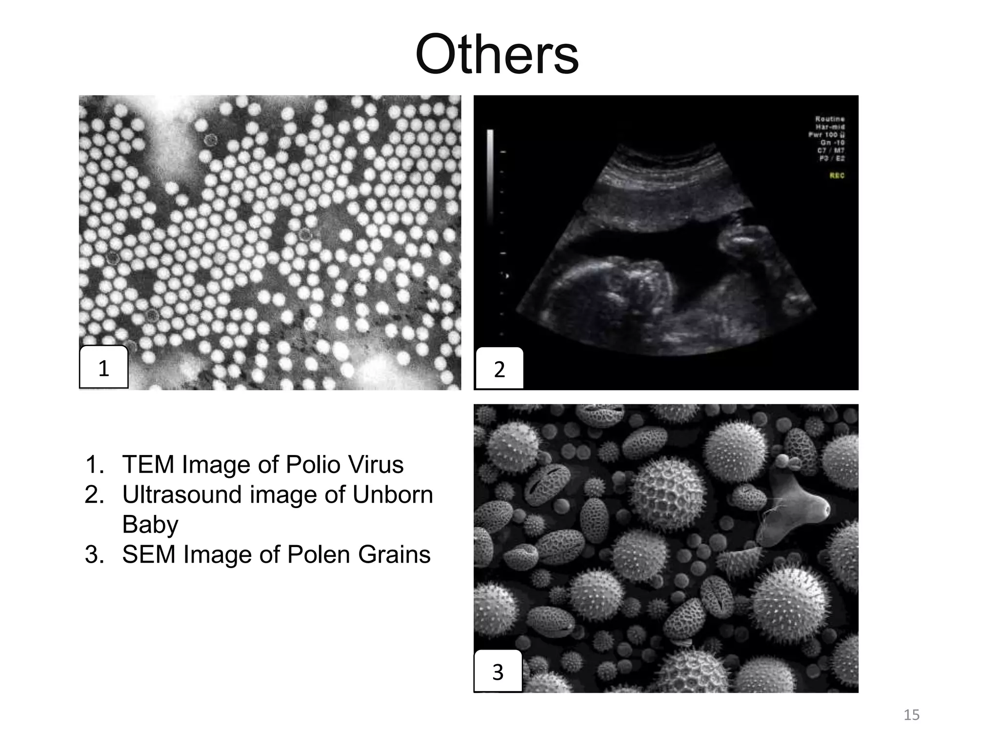 Others
15
1. TEM Image of Polio Virus
2. Ultrasound image of Unborn
Baby
3. SEM Image of Polen Grains
1 2
3
 