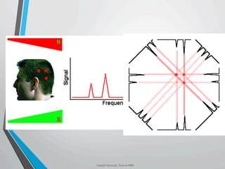 Joseph	Hornack,	Text	on	MRI	
 