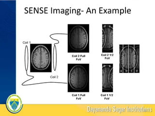 SENSE	Imaging-	An	Example	
18	
 