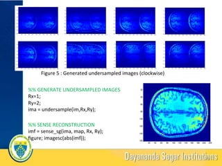 Figure	5	:	Generated	undersampled	images	(clockwise)		
	
20 40 60 80 100 120 140 160 180 200 220
20
40
60
80
100
120
140
160
%%	SENSE	RECONSTRUCTION	
imf	=	sense_sg(ima,	map,	Rx,	Ry);	
ﬁgure;	imagesc(abs(imf));	
%%	GENERATE	UNDERSAMPLED	IMAGES			
Rx=1;	
Ry=2;	
ima	=	undersample(im,Rx,Ry);	
20	
 