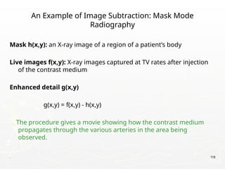 . 118
An Example of Image Subtraction: Mask Mode
Radiography
Mask h(x,y): an X-ray image of a region of a patient’s body
Live images f(x,y): X-ray images captured at TV rates after injection
of the contrast medium
Enhanced detail g(x,y)
g(x,y) = f(x,y) - h(x,y)
The procedure gives a movie showing how the contrast medium
propagates through the various arteries in the area being
observed.
 