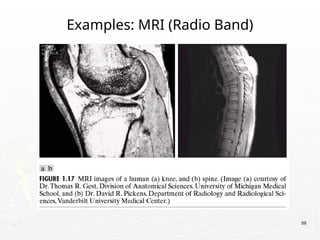 . 59
Examples: MRI (Radio Band)
 