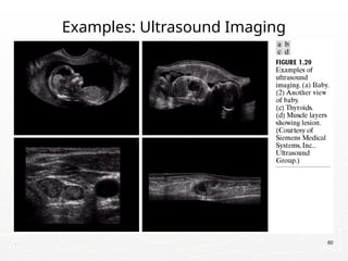 . 60
Examples: Ultrasound Imaging
 