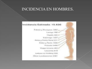 INCIDENCIA EN HOMBRES.
 