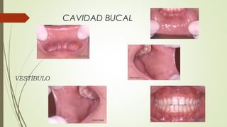CAVIDAD BUCAL
VESTÍBULO
 