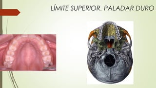 LÍMITE SUPERIOR. PALADAR DURO
 