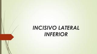INCISIVO LATERAL
INFERIOR
 