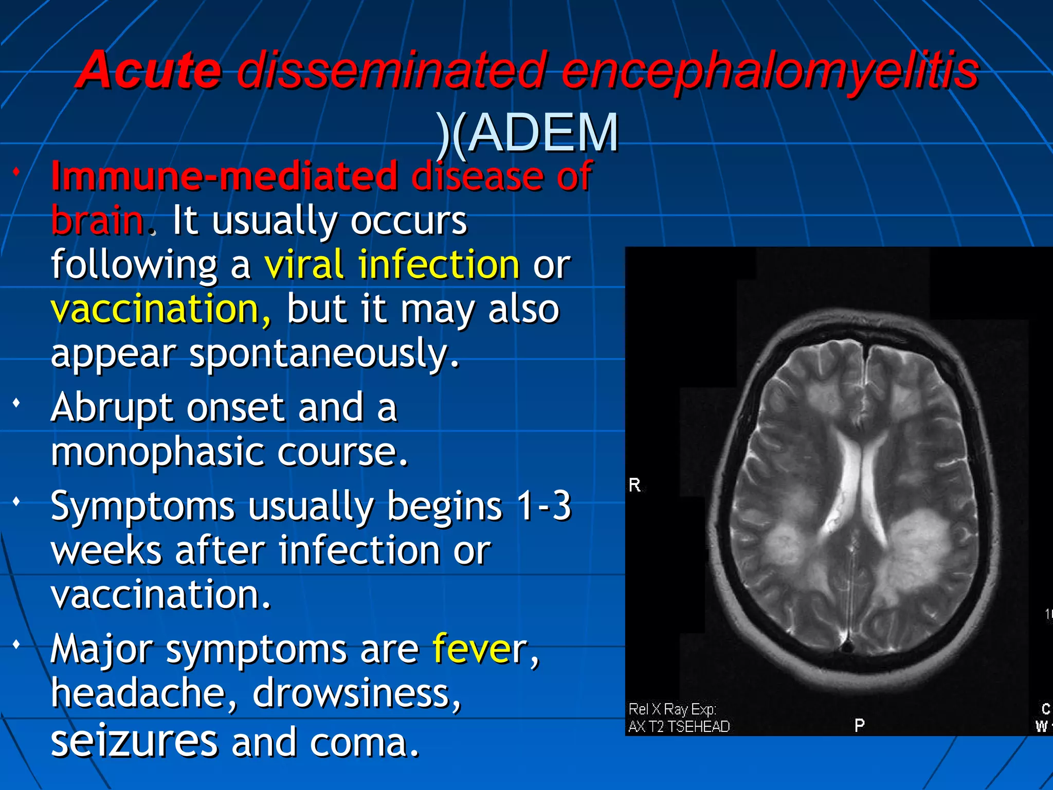 AcuteAcute disseminated encephalomyelitisdisseminated encephalomyelitis
(ADEM(ADEM((
 Immune-mediatedImmune-mediated disease ofdisease of
brainbrain.. It usually occursIt usually occurs
following afollowing a viral infectionviral infection oror
vaccination,vaccination, but it may alsobut it may also
appear spontaneously.appear spontaneously.
 Abrupt onset and aAbrupt onset and a
monophasic course.monophasic course.
 Symptoms usually begins 1-3Symptoms usually begins 1-3
weeks after infection orweeks after infection or
vaccination.vaccination.
 Major symptoms areMajor symptoms are fevefever,r,
headache, drowsiness,headache, drowsiness,
seizuresseizures and coma.and coma.
 