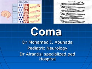 ComaComa
Dr Mohamed I. AbunadaDr Mohamed I. Abunada
Pediatric NeurologyPediatric Neurology
Dr Alrantisi specialized pedDr Alrantisi specialized ped
HospitalHospital
 