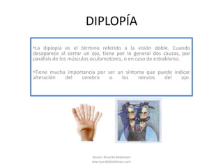 DIPLOPÍA ,[object Object]