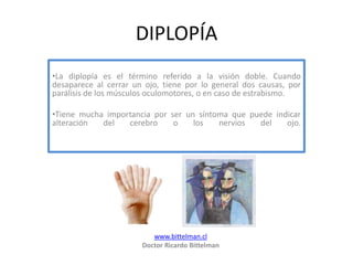 DIPLOPÍA ,[object Object]
