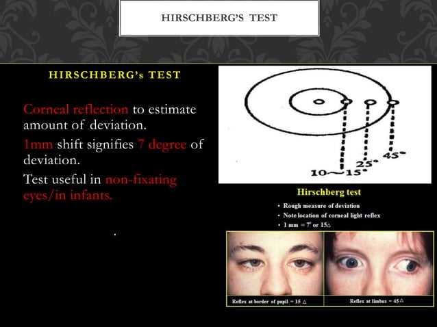 Diplopia | PPTX | Eye and Vision Conditions | Diseases and Conditions