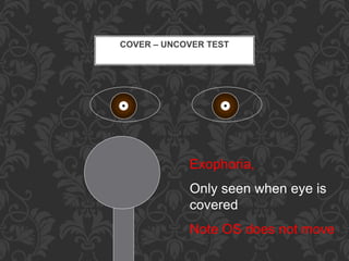 Diplopia | PPTX