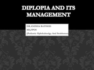 DR.ANISHA RATHOD
MS,FPOS
(Pediatric Ophthalmolgy And Strabismus)
DIPLOPIA AND ITS
MANAGEMENT
 
