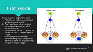 DIPLOPIA.pptx
