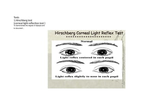Hirschberg Examples DIPLOPIA in Oral and Maxillofacial trauma.pptx