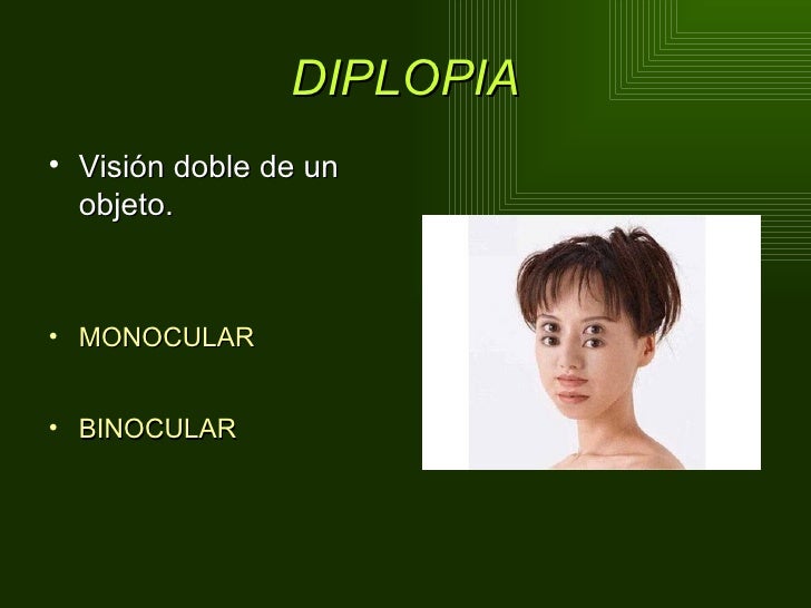 Diplopia binocular tras la cirugía de cataratas