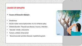 abc diplopia lecture aaaaaaaaaaaaaaaaaaaaaaaaaaaaaaaaaaaaaaa | PPTX