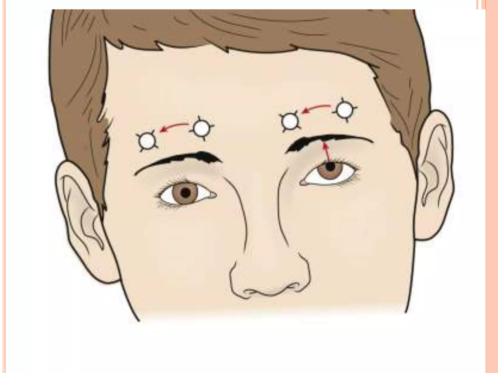 Diplopia approach PPT